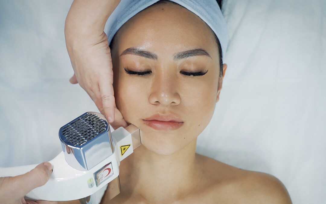 What is IPL, and how does it differ from laser treatment?