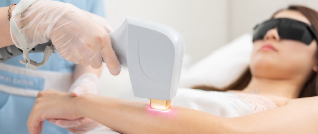 IPL hair removal arm