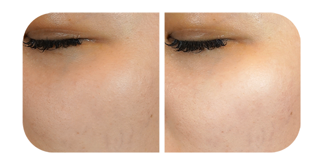 Even Out Skin Tone & Brightens Complexion.