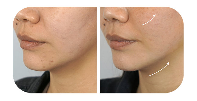 Lift, Tighten & Strengthen Skin.