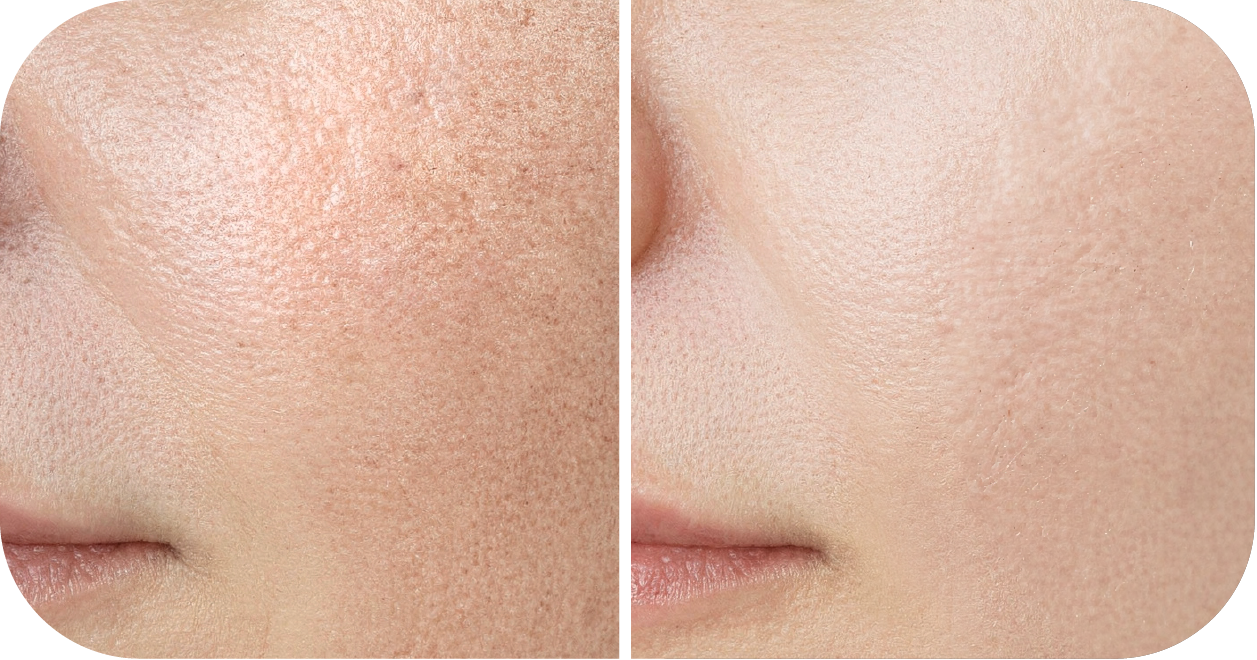 Even Out Skin Tone & Brightens Complexion