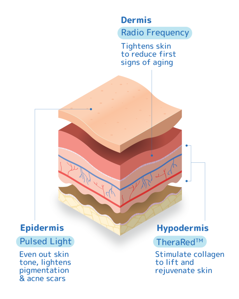 TriLight Therapy 3 Skin Layers