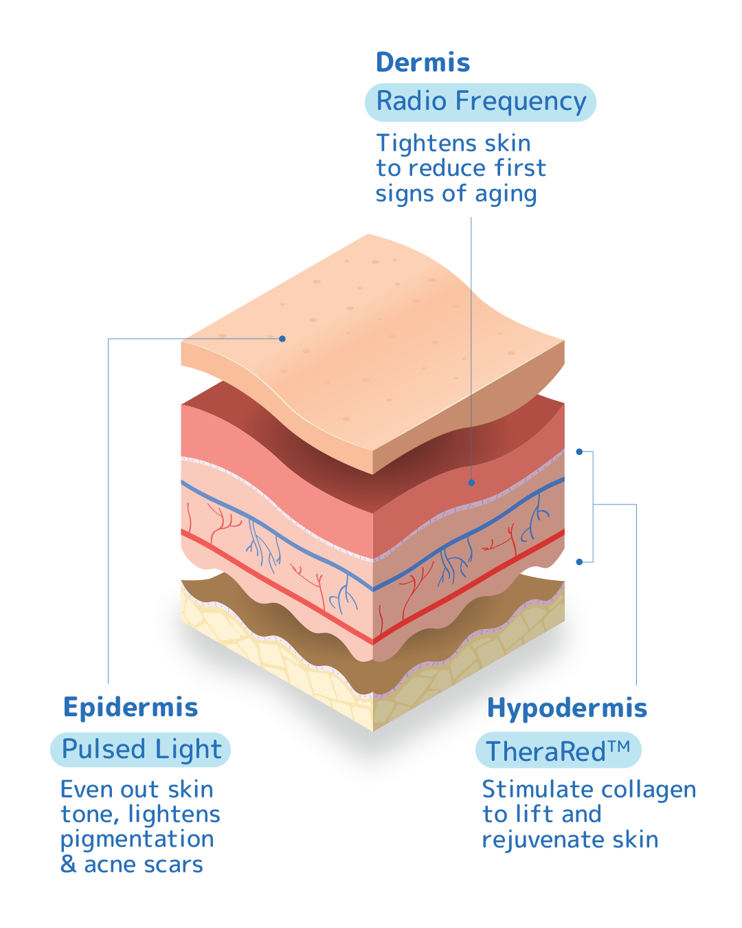<p>TriLight™ Technology<br />
Treating Multiple Concerns In 1 Session</p>
