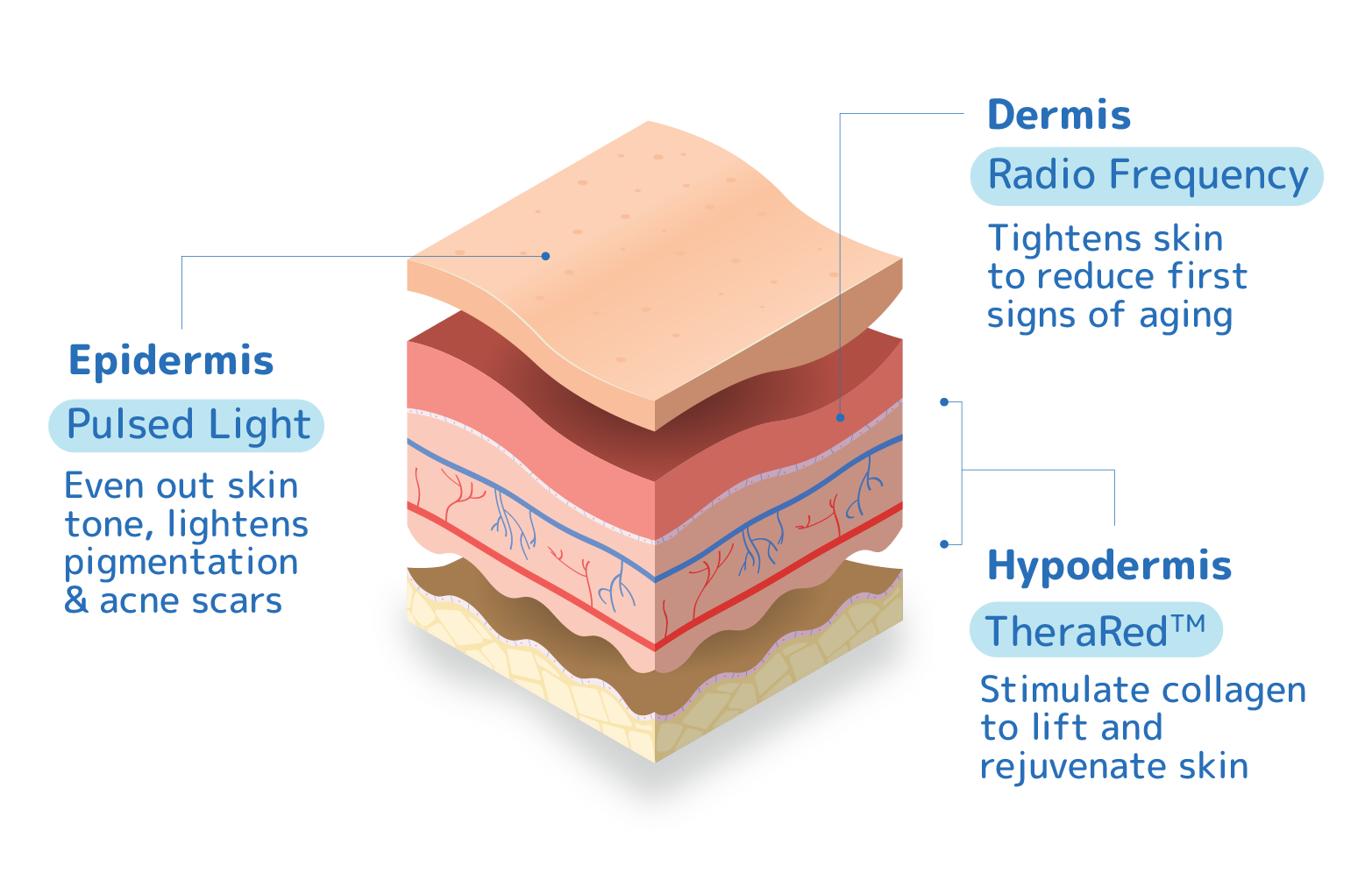 <p>TriLight™ Technology<br />
Treating Multiple Concerns In 1 Session</p>
