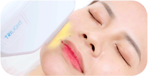 Targeting Epidermis with Pulsed Light