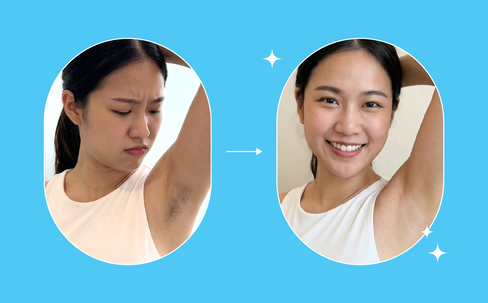 Why We Focus on Progressive Hair Reduction at Japan IPL Express